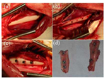 Surgical procedures