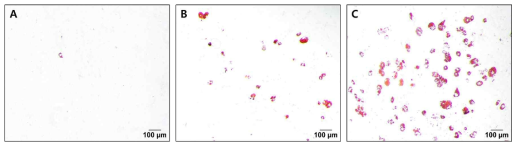 엑소좀에 의한 피하지방세포의 분화영향(Oil red O 염색). A: 미분화, B: 미분화 +엑소좀, C: 분화