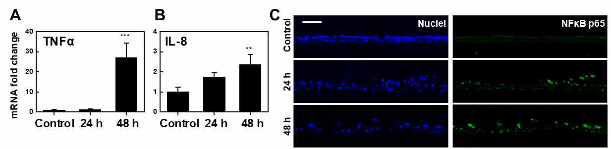 100μM CMIT/MIT 노출 폐포 장벽 세포의 염증 반응 (a-b) mRNA expression of pro-inflammatory cytokines (c) NFκB p65 IHC