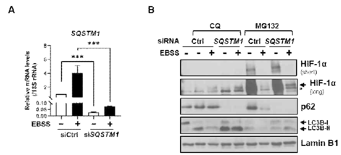 Normoxia에서 UPS와 macroautophagy에 의한 HIF1α 분해 조절