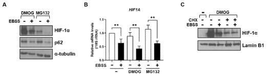 Macroautophagy에 의한 VHL 의존적 HIF1α degradation