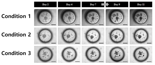 MCF-10A 세포수 제어를 통한 오가노이드 배양환경 구축