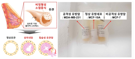 상피내암(DCIS)과 침윤성 유관암(IDC)에 대한 연구를 위한 유방세포주 확보