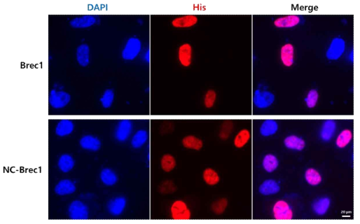 Localizations of Brec1 and NC-Brec1 protein in HeLa cells. Immunofluorescence was performed at 48 h after transfection of the expression plasmid. Transfected cells were stained in DAPI for nuclei (Blue) and anti-His antibody for His tagged Brec1 protein (Rhodamine, Red)