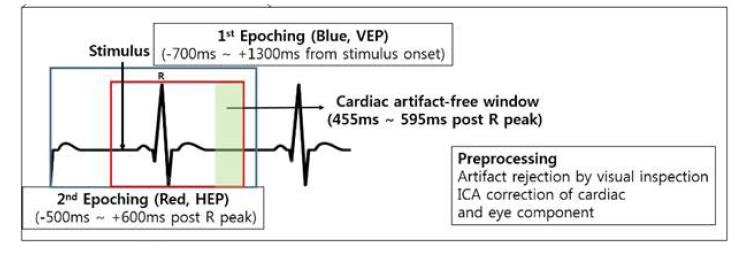 Event-related potential의 Epoching