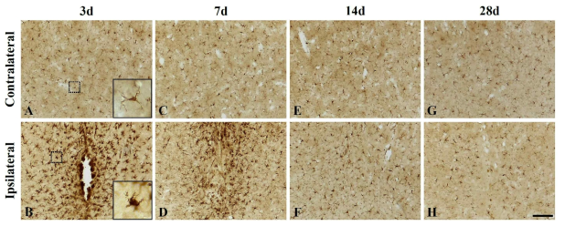 Iba1 면역조직화학염색 (scale bar = 100 μm)