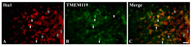 Iba1/TMEM119 이중 면역형광염색 (scale bar = 35 μm)