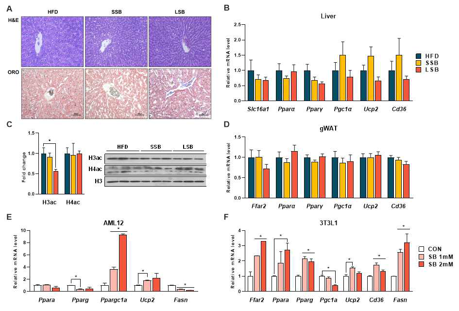 Butyrate effects on liver and gonadal white adipose tissue (gWAT). (A) Liver tissue H&E staining and oil red O (ORO) staining. (B) Hepatic gene expression and histone acetylation levels. (D) Gene expression levels of adipose tissue. (E, F) Gene expression level of butyrate treated AML12 and differentiated 3T3L1, 24 hours and 5 days, respectively