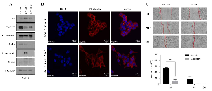 MCF-7 유방암 세포에서 Rnf125의 발현 억제에 의한 EMT 및 migration 능력 증가 확인