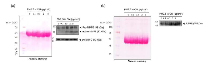 PM2.5 노출된 RAW264.7 세포의 conditioned media에서 MMP-9, cystatin C, RAGE의 양적 분석