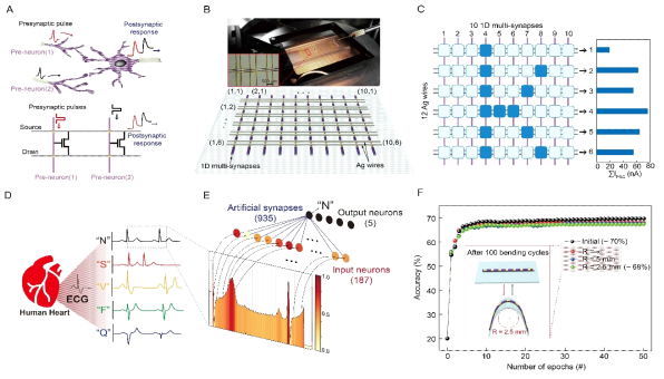 (A) 뉴런과 시냅스의 신호전달 개략도(상), 병렬 타입(NOR-type)의 인공 시냅스 어레이(synaptic array)구조(하), (B) 제작된 병렬 타입 어레이 구조와 개략도. (C) 인코딩된 ‘k“ 패턴, (D) 시뮬레이션에 사용된 정상 맥박형태와 4가지 부정맥 형태, (E) 심전도(ECG) 유형 학습을 위한 인공 뇌신경망 모델, (F) 70 %의 인식률을 보인 심전도 패턴 학습 테스트 결과