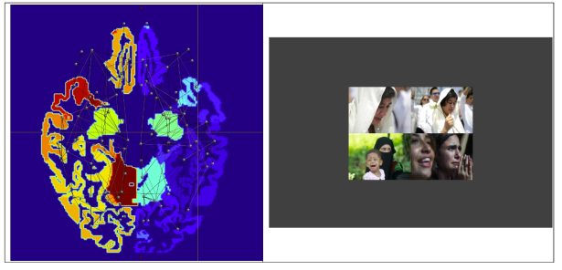 (좌)Connectome 분석 결과 (우)감성지능 훈련 과제 예시