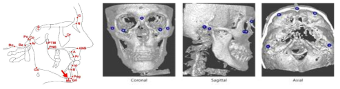 두개안면부 landmark point