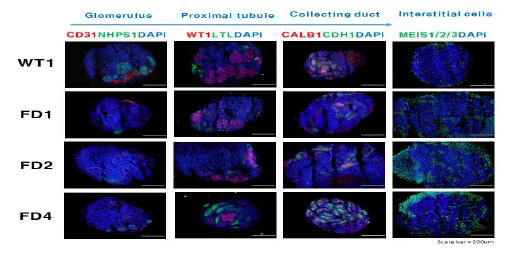분화된 신장 오가노이드에서 각 세포 특이적 마커들의 발현