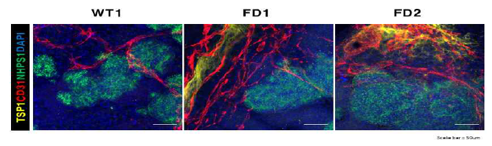 면역 형광 염석을 통해 확인한 사구체 구성 세포인 혈관세포(CD31)와 다리세포(NPHS1) 염색 및 TSP1 축적확인