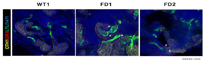 면역 형광 염색을 통해 확인한 세뇨관(LTL)과 집합관(CDH1) 염색 및 Gb3 축적
