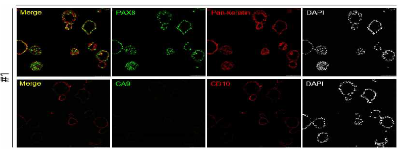 신장 조직 유래의 3D 오가노이드에서 신장 특이 마커에 대한 면역형광염색 결과