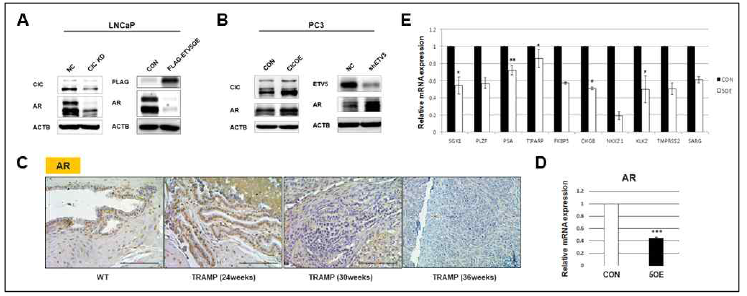 ETV5 과발현 세포주와 TRAMP에서의 AR 발현 감소. A,B) CIC과 ETV5 발현 조절 조건에서의 AR 단백질 발현량 변화. C) TRAMP 모델에서 전립선암 진행에 따른 AR의 발현 분석. 24, 30, 36 주령의 TRAMP 마우스에서 진행함 (n=5, 5, 5). AR의 발현이 증가하는 양상을 보이며, CRPC-NE 단계 (36주령) 에서 발현이 완전히 감소함. D) LNCaP 세포주에서 ETV5 과발현에 따른 AR mRNA 발현 감소. E) LNCaP 세포주에서 ETV5 과발현에 따른 AR 표적 유전자들의 발현 감소
