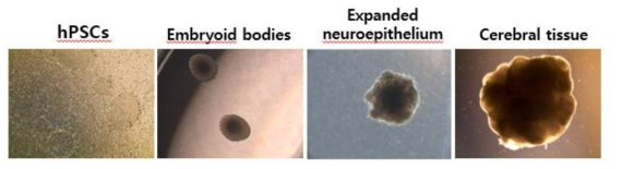 뇌 오가노이드 제작 과정 (왼쪽부터 오른쪽 방향으로 진행)