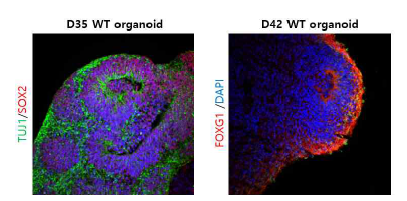 미니뇌 오가노이드에서 35일째 TUJ1(녹),SOX2(적) 발현(좌) 및 42일째 FOXG1(적),DAPI(청) 발현(우)