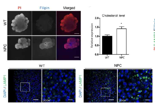 니만-피크병 미니뇌 오가노이드에서 콜레스테롤 축적과 라이소솜 기능의 결함