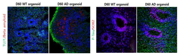 정상(WT) 및 치매 환자(AD) 오가노이드에서 Ab 및 p-Tau 축적 양상