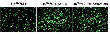 ASK1 과발현에 의한 UbG76V-GFP 형광 증가