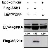 ASK1 과발현에 의한 UbG76V-GFP 단백질 발현 증가