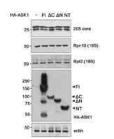 ASK1 과발현에 따른 proteasome 구성 단백질의 발현 확인