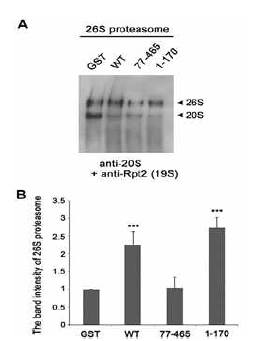 Parkin 야생형 및 잘린 형태의 돌연변이 과발현에 따른 proteasome 조립 변화