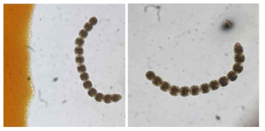 2020년 10월 22일 Cochlodinium polykrikoides 현미경 관찰사진