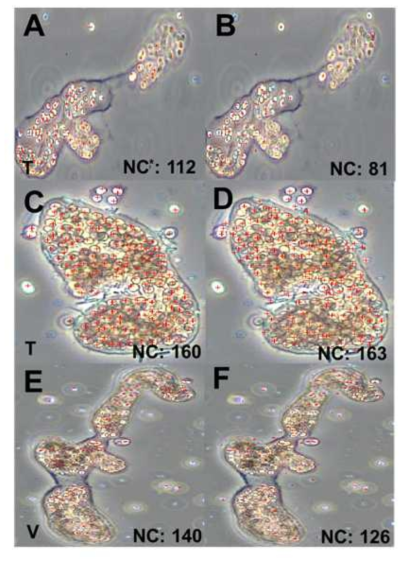 Microcystis wesenbergii의 Cell counting 모델 학습 결과