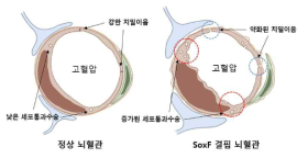 SoxF 결핍 뇌혈관은 스트레스 상황에서 뇌혈관 투과성이 증가한다