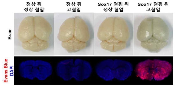 고혈압 조건에서 Sox17 결핍 생쥐에서만 Evans blue의 뇌혈관 누출이 관찰됨