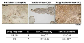 위암 환자의 약물 치료 성적에 따른 partial response (PR), Stable disease (SD) 그리고 Progressive disease (PD)로 분류 후 NINJ2 발현 정도를 평가함 (Immunohistochemistry, IHC)