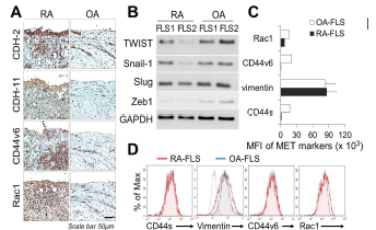 Mesenchymal-epithelial transition in RA and OA FLS using MET markers. Localization of MET markers in RA and OA synovium (A). Expression of transcription factors related with MET (B) and protein expression in RA and OA FLS using flow cytometry (C,D). Cadherin expression in RA and OA FLS (E) and various cell line (F)