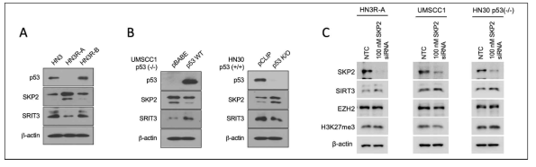 Skp2에 의한 SIRT3 발현 확인