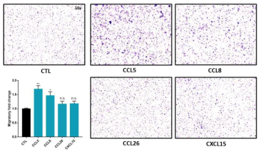 Peritoneal macrophage를 이용한 chemokine migration assay