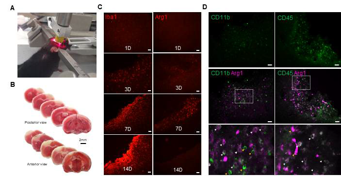 광혈전 뇌경색 확립 (photothrombotic infaction) 및 arginase의 macrophage 발현