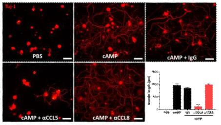 대식세포 조건배지 Neurite outgrowth assay. 신경세포-대식세포 공배양에 CCL5 및 CCL8 기능저해 항체를 처리후 조건배지를 등측신경절 신경세포에 처리