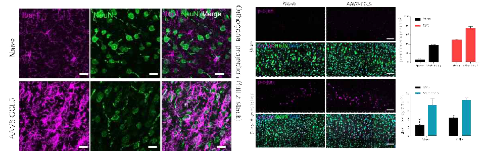 조직 내 AAV8-CCL5 과발현 이후 염증세포 및 재생관련유전자 발현. (좌) AAV8-CCL5의 대뇌피질 주사 이후 NeuN 신경세포와 Iba-1 염증세포 조직염색. (우) AAV8-CCL5의 대뇌피질 주사 및 척수 손상 이후 phospho-c-jun의 발현 측정