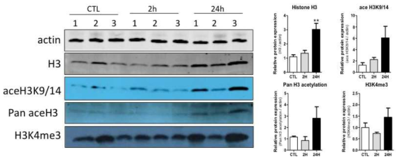 좌골신경 손상 후 후근신경절에서 H3 히스톤 단백질 및 acetylation 변화