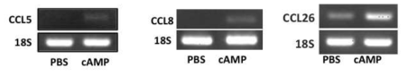대뇌피질신경세포 배양에서 cAMP에 의한 중추신경 케모카인 유전자 발현 증가
