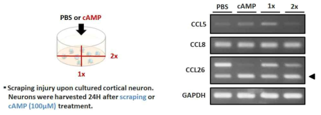 대뇌피질 배양세포에서 scrape 손상에 의한 중추신경 케모카인 발현