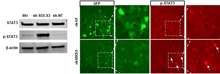 SOCS3 억제 후 STAT3 활성화