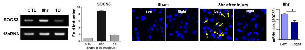 RST 손상이후 red nucleus에서 8시간째에 증가하는 SOCS3