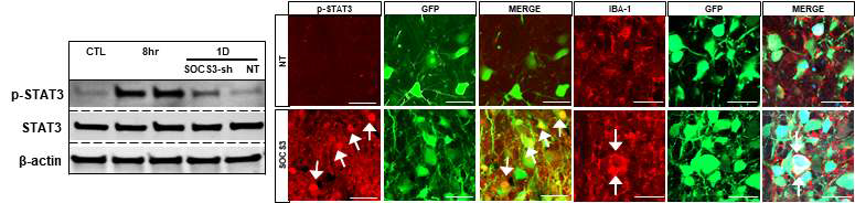 SOCS3 knockdown 후 red nucleus에서 발현된 p-STAT3와 신경세포주변에 염증반응