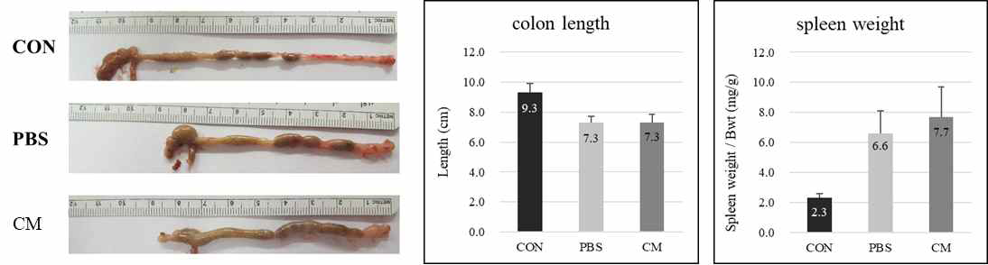 Comparison of colon length and spleen weight