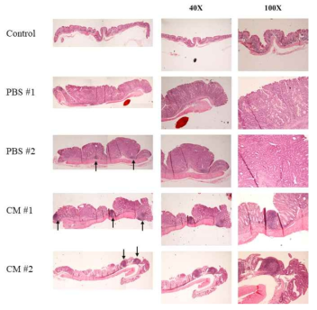 Representative H&E staining of colon tissues from PBS and CM treated mice. (Arrows indicate the infiltrated lymphocytes.)