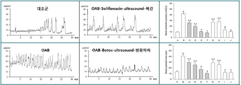 약물과 microbubble 투여 후 ultrasound 자극에 따른 배뇨기능에 미치는 영향. [좌] Basal contraction pressure 결과, [우] Basal contraction time 결과. [□] Non-ultrasound 집단, [▨] Ultrasound 자극집단. (A) 대조군, (B)OAB 유발군, (C)OAB-solifenacin 복강투여군, (D)OAB-solifenacin 방광투여군, (E)OAB-Botox 방광 투여군, (F)OAB-Botox 방광피하 투여군, (G)OAB-solifenacin 복강 투여군, (H)OAB-solifenacin 방광 투여군, (I)OAB-Botox 방광 투여군, (J)OAB-Botox 방광피하 투여군. *represents P < 0.05 compared to control group. #represents P < 0.05 compared to the OAB group